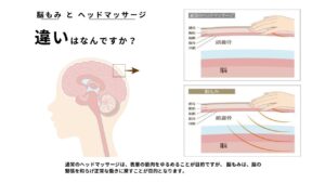 脳もみとヘッドマッサージの違い