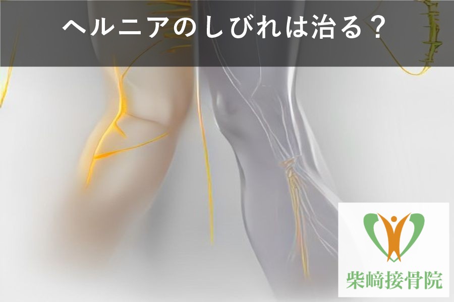 ヘルニアのしびれは治る？坐骨神経のイメージ図と柴﨑接骨院ロゴ