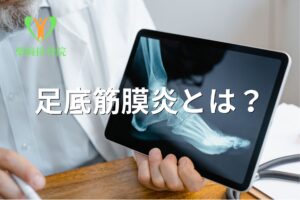 足底筋膜炎によるかかと・足裏の痛みを示すイメージ図(群馬県館林市)
